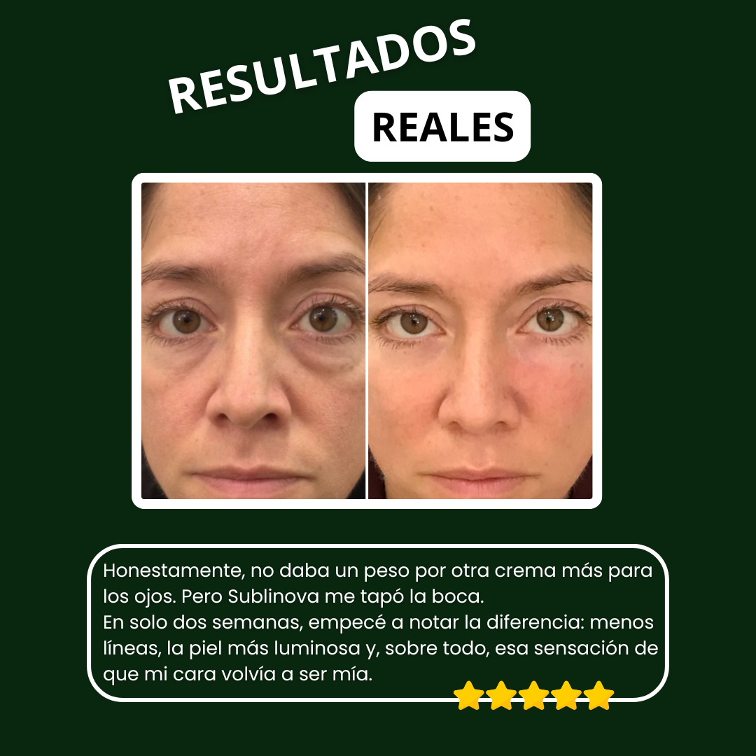 Sublinova | Reactiva el contorno de tus ojos con este bálsamo